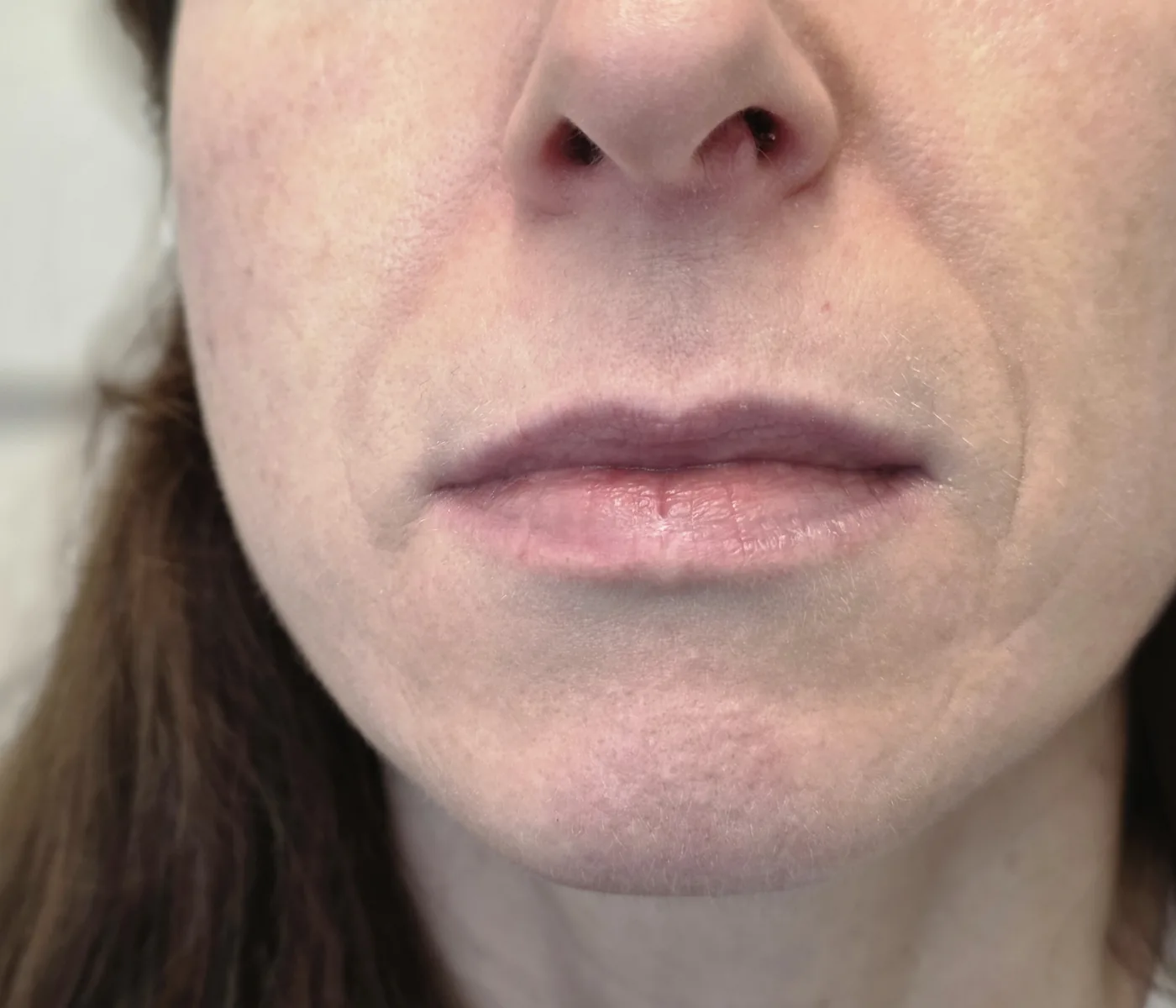 Before: lip blush