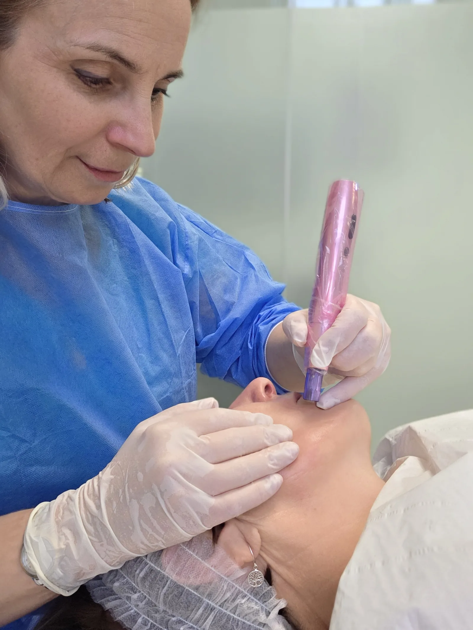 Tanya performing microneedling with a professional pen